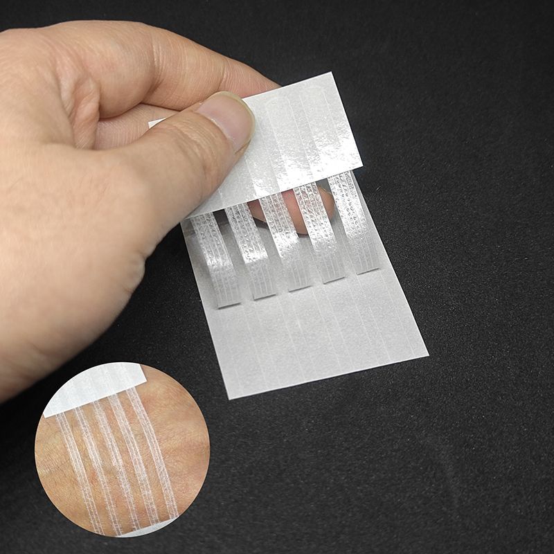 Sutures,Patch