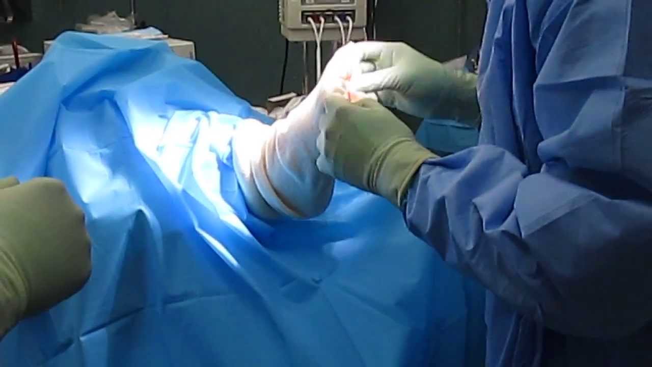 Podiatry,Drape